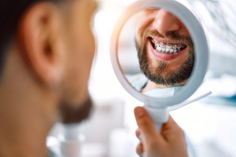 Debunking Myths About Orthodontic Treatments