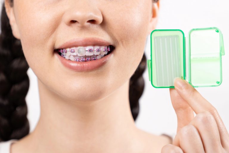 Orthodontic Care in Toronto: Understanding Pain and Discomfort with Braces
