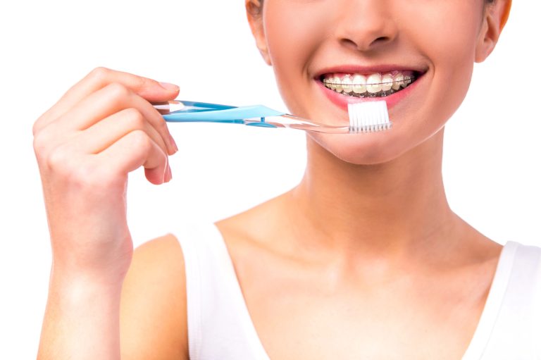 Orthodontic Care in Toronto: Maintaining Healthy Teeth Between Appointments