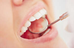 Connective Tissue Grafts