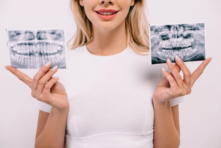 Early Signs You May Need Orthodontic Treatment