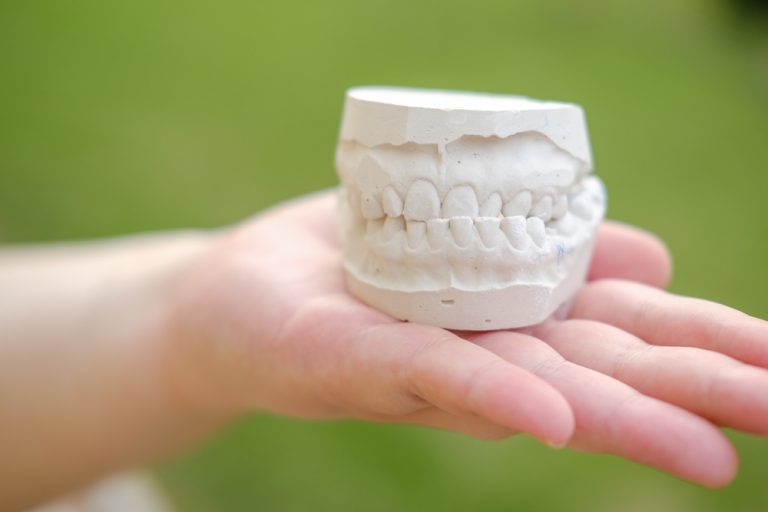 Jaw Alignment Signs You’re Overlooking: A Dentist’s Take Before Summer Begins