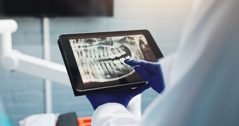 What Improving Dental Crowding Does for Whole-Body Health