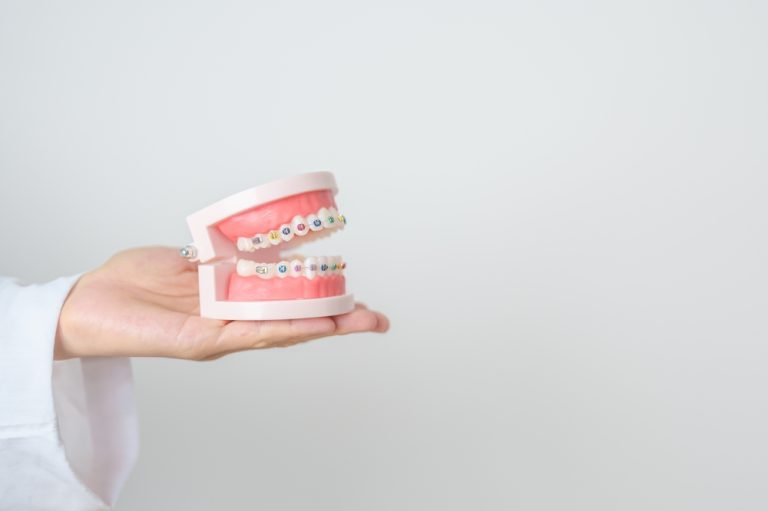 Protecting Gum Health During Orthodontic Treatment: Beyond Brushing and Flossing