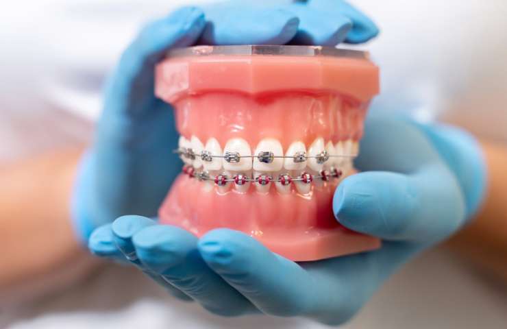 Debunking Myths About Orthodontic Treatments
