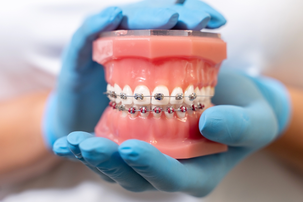 Debunking Myths About Orthodontic Treatments