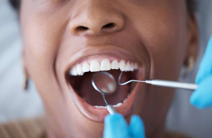 A Waterloo Dental Guide to Oral Microbiome Reset
