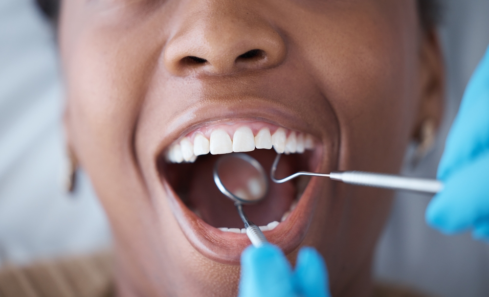 A Waterloo Dental Guide to Oral Microbiome Reset